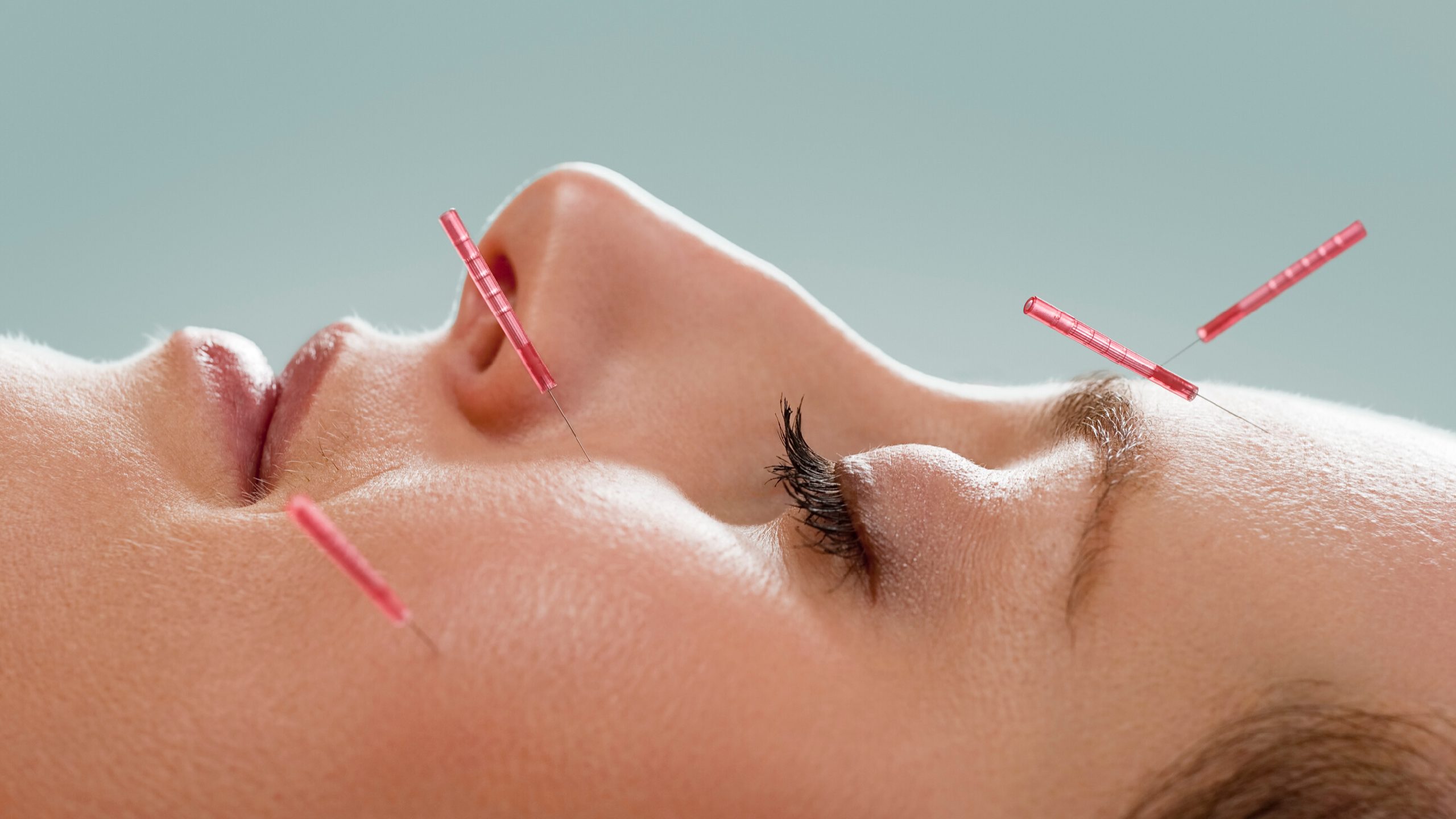 Cosmetic acupuncture
